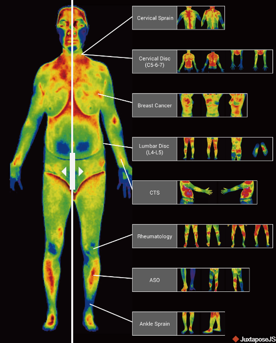 ThermaLens Scan Image. haus of life and co