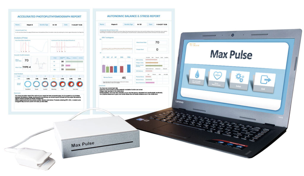 Image of Max Pulse with a sample of the report