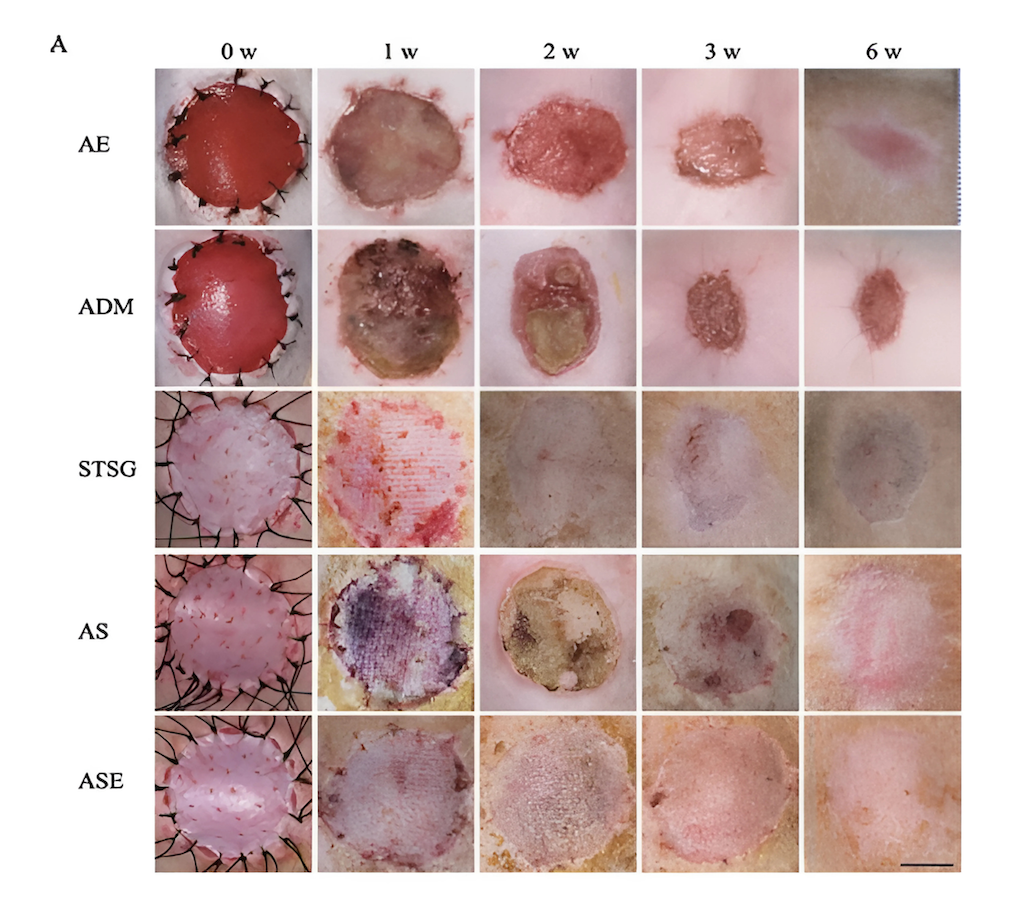 Image of different skin grafts. Haus of life and co