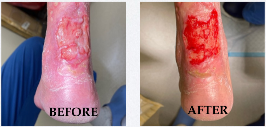 XSONX Before and After Image 2. Haus of Life and Co